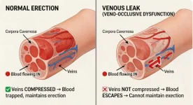 venous-leak-ed.webp